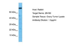 ZNF160 Rabbit anti-Human, Polyclonal, Novus Biologicals 0.1 mL | Buy Online | Novus Biologicals | Fisher Scientific